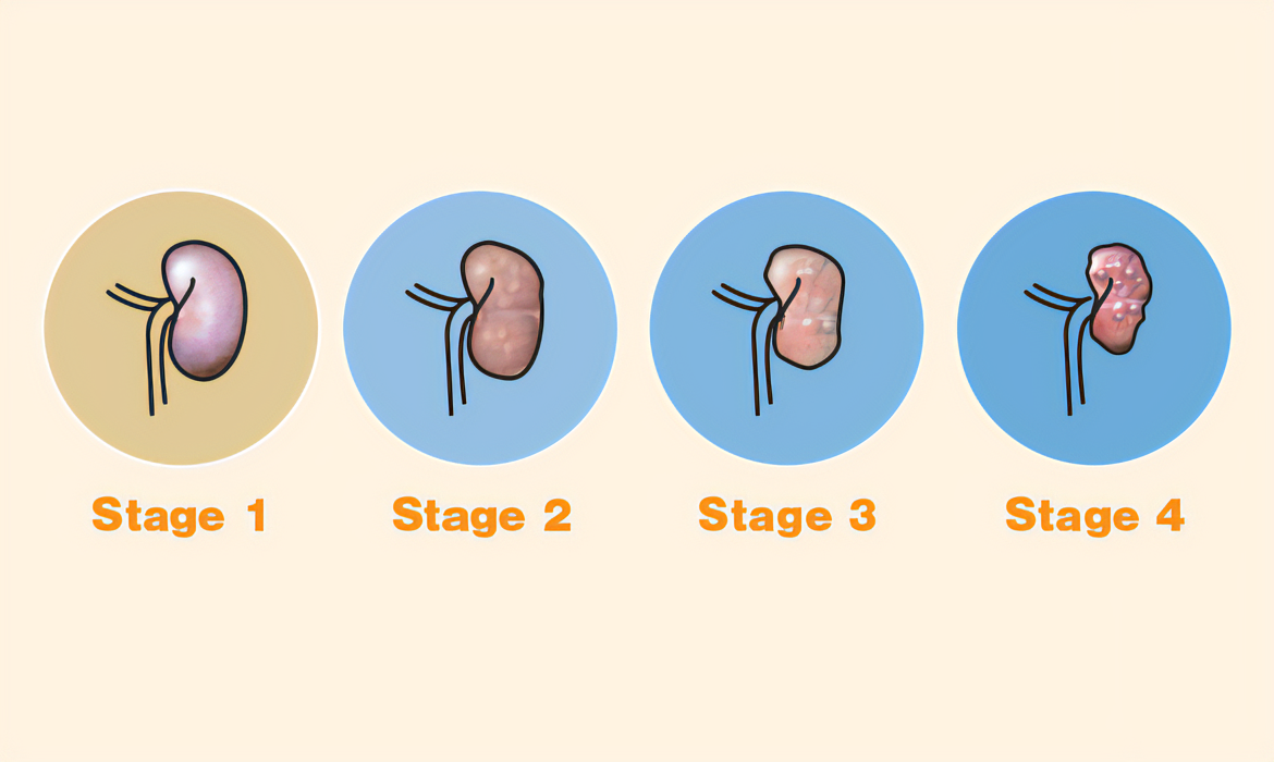 犬の腎臓病の4つのステージ
